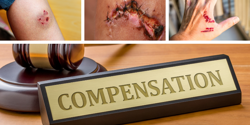 South Carolina Dog Bite Lawyer 